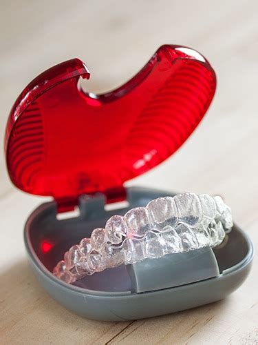 Invisalign South Loop Chicago Clear Braces Orthodontist