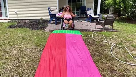 Dhd Amputee Nude XHamster