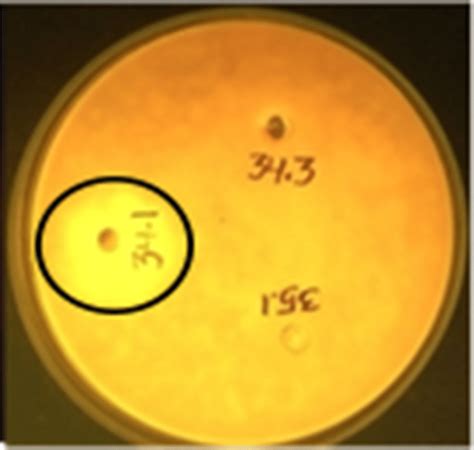 Lipase Chromogenic Plate Assay For Screening Of Most Efficient Download Scientific Diagram