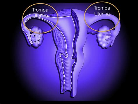 Funcao Das Tubas Uterinas