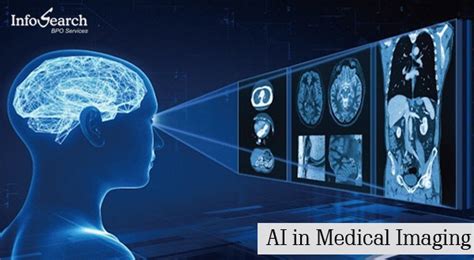 Artificial Intelligence In Medical Imaging Infosearch Bpo News