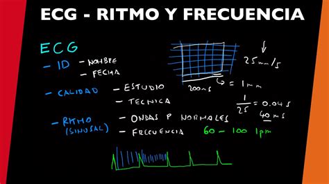 Ecg Ritmo Y Frecuencia Youtube