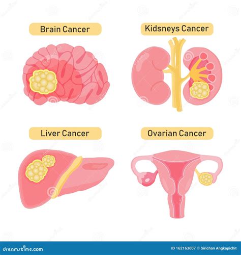 Main Types Of Cancer