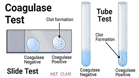 Coagulase Test Practical And Theory Video 💥🦠 Coagulase Test For Staphylococcus Aureus Mltclass