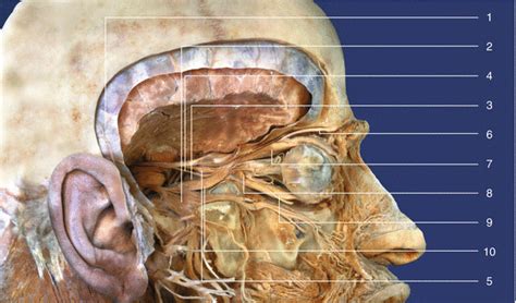 Supraorbital Nerve Cadaver