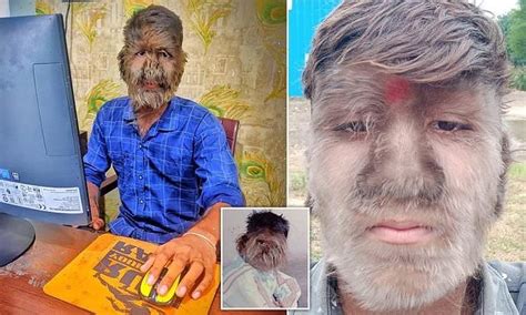 Emmerdales Rosie Bentham Has Co Stars Swooning As She Dons Barely There Bikini Hot Lifestyle News