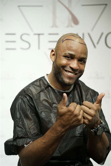 Afro Hair Transplantation - Estenivo EN