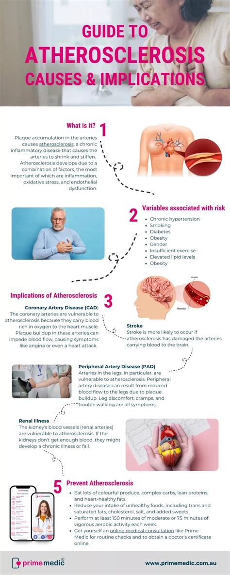 PPT - Guide to Atherosclerosis Causes & Implications PowerPoint ...