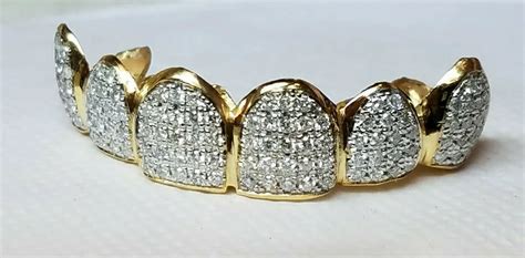 Real Gold And Diamond Grillz Hotsell | bellvalefarms.com