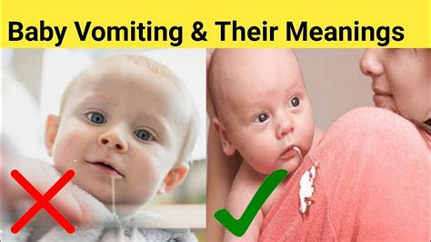 Should You Feed A Baby After They Projectile Vomit at Sergio Erik blog