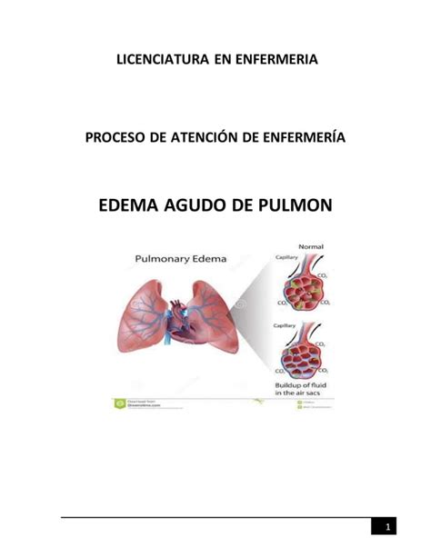 PROCESO DE ATENCIÓN ENFERMERÍA EDEMA AGUDO PULMONAR PDF