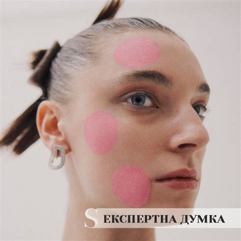 Акне, розацеа, дерматит: найбільш поширені помилкові діагнози ...