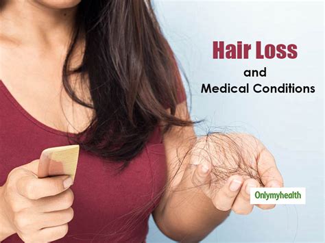 6 Medical Conditions That May Cause Hair Loss Onlymyhealth