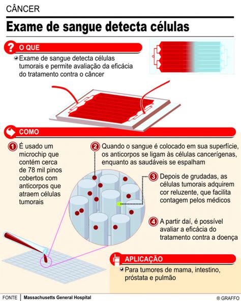 Novo exame de sangue detecta mais de 50 tipos de câncer IBCC