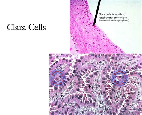 Respiratory - Clara Cells - Histology | Science notes, Teaching biology, Tools for teaching