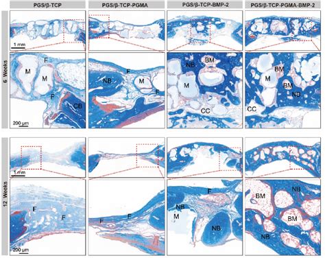 Histological Evaluation Of Bone Regeneration Sections At 6 Weeks And 12