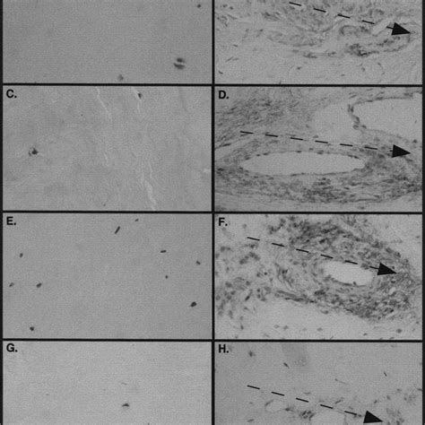 Rt Pcr Of A Sma Acta Collagen I Col A Collagen Iii Col A