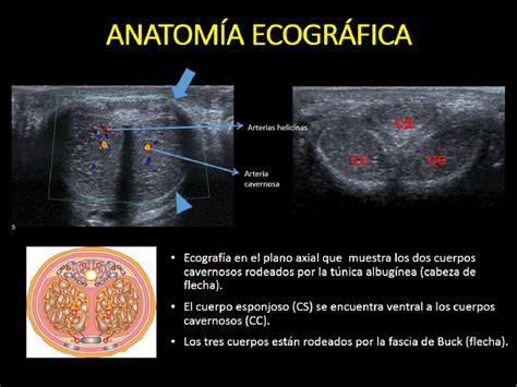 Figure 4 from ECOGRAFÍA DOPPLER PENEANA EN EL ESTUDIO DE LA DISFUNCIÓN