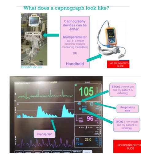 How Do We Monitor Anaesthesia Capnography Flashcards Quizlet