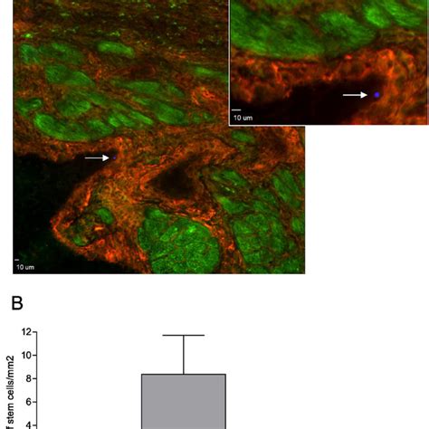 In Vivo Stem Cell Retrieval A Fluorescence Microscopy Image Of