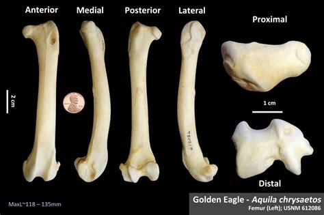 Bones Osteoid Bone Identification