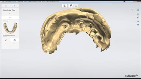 How To Scan A Post Core Impression In Shape Youtube