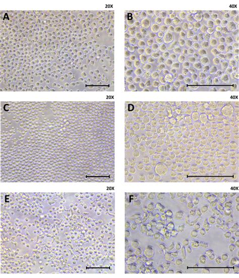 Macrophage Differentiation And Polarization Into An M Like Off