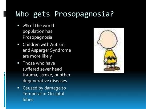 Prosopagnosia