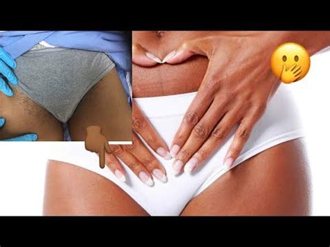 HOW TO CLEAR BIKINI LINE VAGINAL HYPERPIGMENTATION CLEAR AFTER ONE MONTH One Secrete