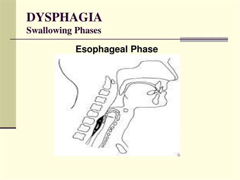 Ppt Comprehensive Dysphagia Management Powerpoint Presentation Free