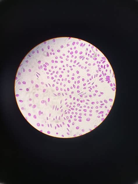 Anaphase Under Microscope