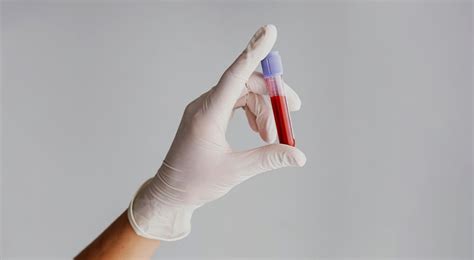 26 Facts About B Negative Blood Type - Facts.net