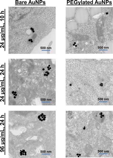 Representative Cellular Tem Images Showed Differences In Cellular