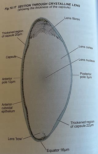 Hoa Week Lens Choroid And Vitreous Flashcards Quizlet