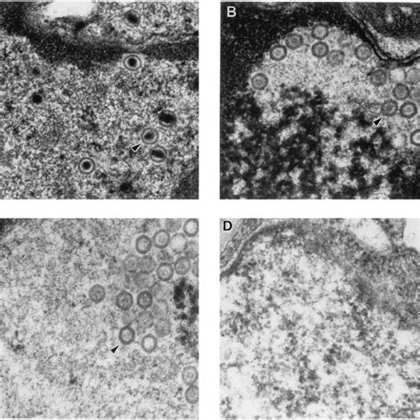 Electron Micrographs Of Vero Cells Infected With Hsv Strain F