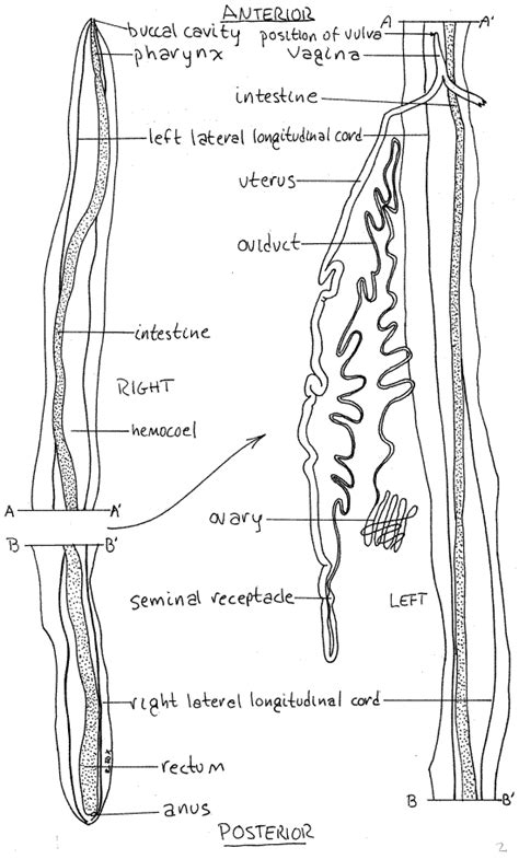 Ascaris Lumbricoides Male And Female Cross Section