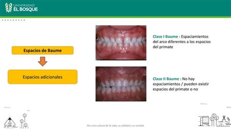 Desarrollo de oclusión en Dentición temporal Mixta y permanente PPT