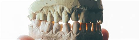 bad teeth bad health doccheck