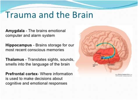 Fight Or Flight Response Brain