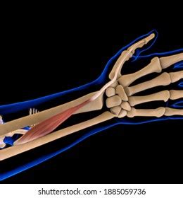 De Quervains Tenosynovitis 3d Illustration Mommys Stock Illustration