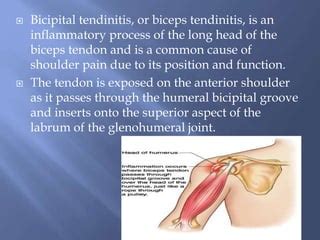 Bicipital tendonitis & Rehabilitation | PPT