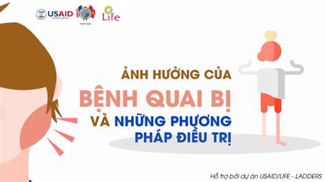 Ảnh hưởng của quai bị và phương pháp điều trị Glink