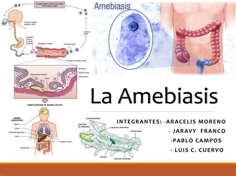 Amebiasis Medilove Udocz