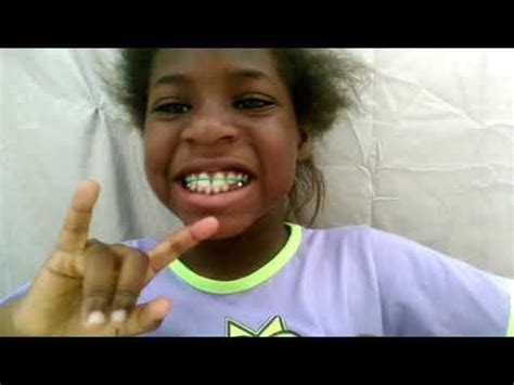 How to make fake braces with rubber bands - YouTube | Fake braces ...