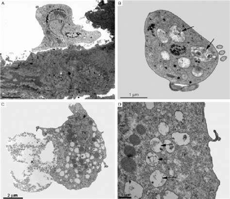 Trichomonas Vaginalis A C And Trichomonas Foetus C D After Download Scientific Diagram