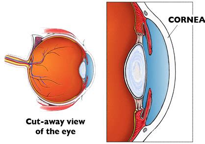 Cornea Specialists Cornea Conditions Treatments Icon Eyecare Grand