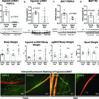 Obesity And Diabetes Led To White Adipose Tissue Neuropathy The Btbr