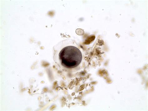 Balantidium Coli Cyst Label