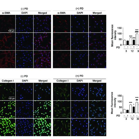 PD Attenuates Pathological Matrix Stiffness Induced Renal Fibroblast