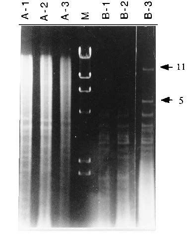 Agarose Wt Vol Gel Electrophoresis Pattern Of The Hindiii